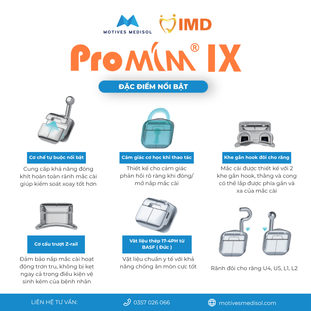 Đặc điểm nổi bật của Mắc cài tự buộc PromimIX